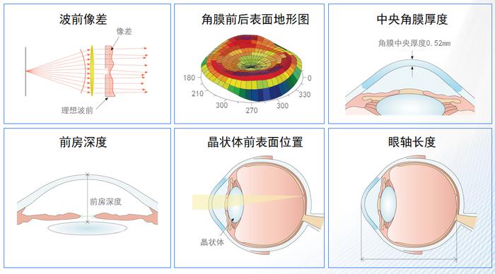 近视眼最新技术,前沿科技助力，近视眼治疗迎来突破性新进展。